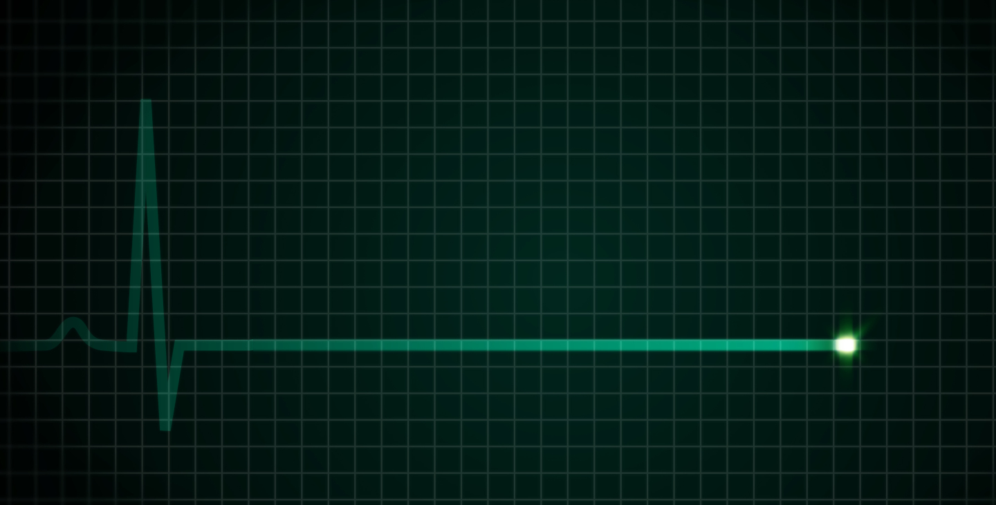 Nulllinie EKG