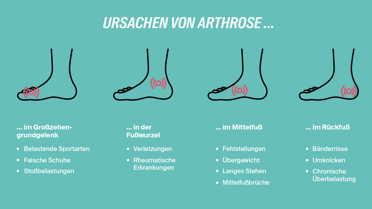 Leichtes Surren Im Fuss
