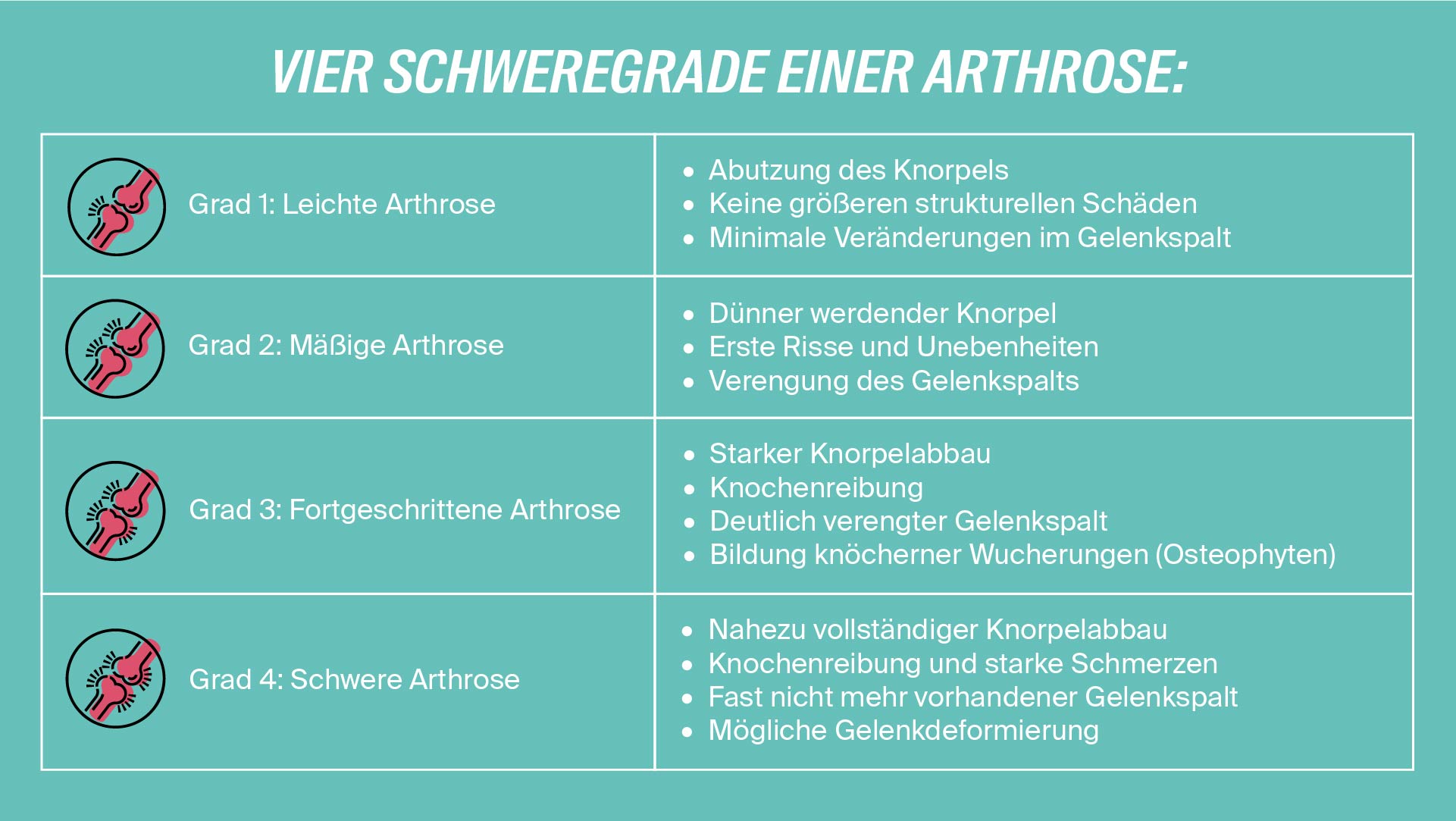 Schweregrad von Arthrose in der Hand